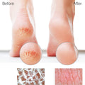 Glass Foot File Callus Remover