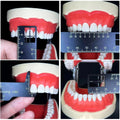Custom Metal Dental Precision Measuring Ruler